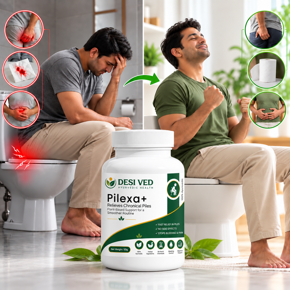 Desived Pilexo+ | Piles, Pain, Itching & Swelling Relief | 100% Ayurvedic