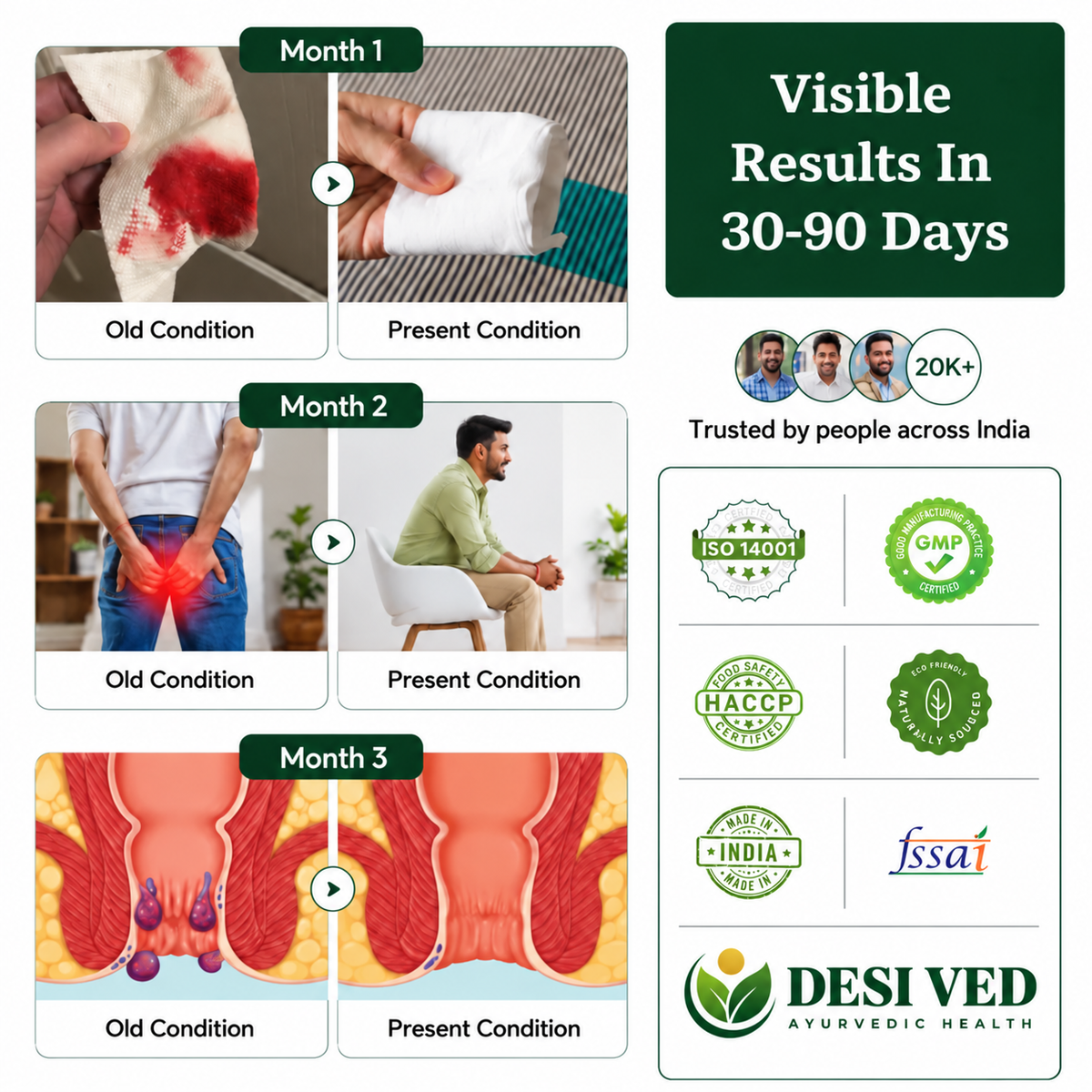 Desived Pilexo+ | Piles, Pain, Itching & Swelling Relief | 100% Ayurvedic